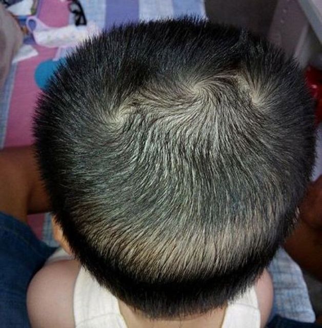 Anggapan Absurd Bocah dengan Jumlah Pusar Rambut Lebih dari Dua. Katanya Aktif Banget, Bun~