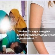 Cryptic Pregnancy Menimpa Seorang Ibu di Cianjur. Bisakah Melahirkan Tanpa Merasa Hamil Sebelumnya?