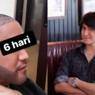 Tampil dengan Kepala Plontos, Kevin Aprilio Jalani Transplantasi Rambut. Akui Insecure