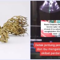 Menyebabkan Pendarahan Hingga Rahim Robek, Kenali Rumput Fatimah Lebih Dalam, Yuk!