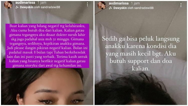 Umumkan Kelahiran sang Anak yang Prematur, Audi Marissa Sedih Melihat Komentar Negatif Warganet