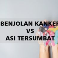 5 Cara Membedakan Benjolan Kanker dan ASI yang Tersumbat. Yuk, Pahami Sejak Dini!