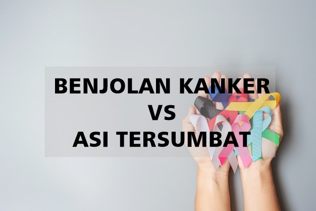 5 Cara Membedakan Benjolan Kanker dan ASI yang Tersumbat. Yuk, Pahami Sejak Dini!