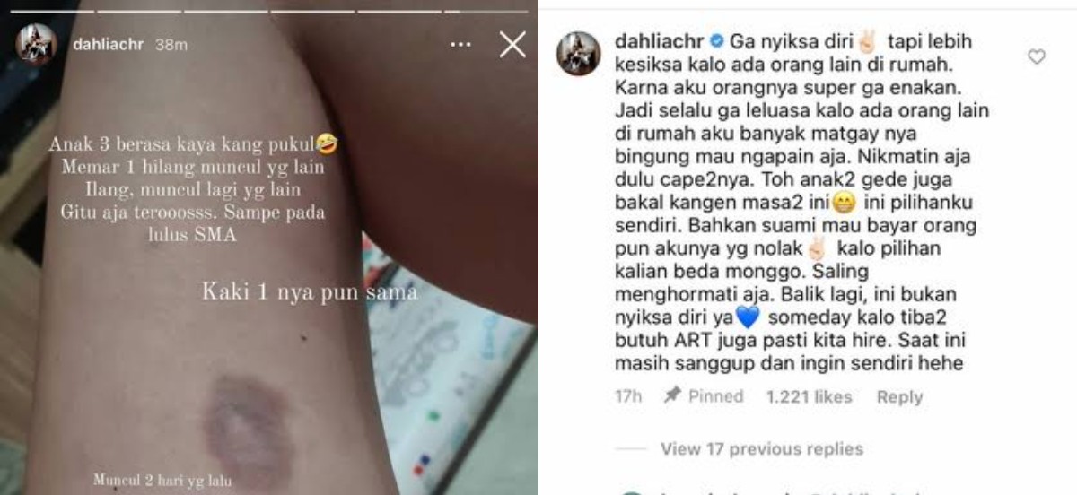 Tunjukkan Bekas Memar di Tubuh, Aksi Dahlia Poland Urus 3 Anak Tanpa ART Bikin Kagum