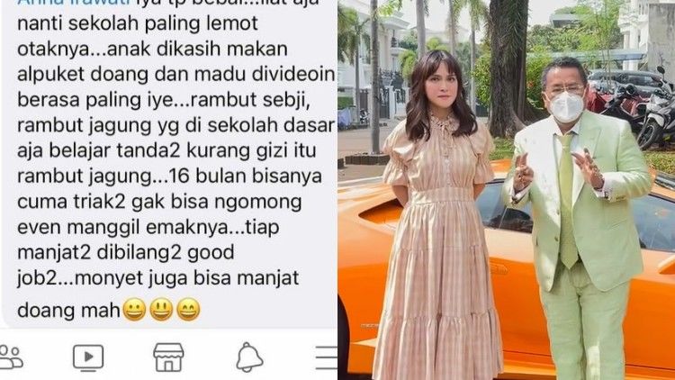 Buntut Anak Dikatai Kurang Gizi, Shandy Aulia Gandeng Hotman Paris Tuntut Pelaku Perundungan