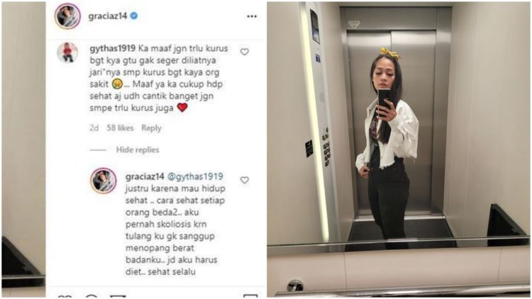 Dikritik Terlalu Kurus, Gracia Indri Ungkap Derita Skoliosis: Tulangku Nggak Kuat, Jadi Harus Diet