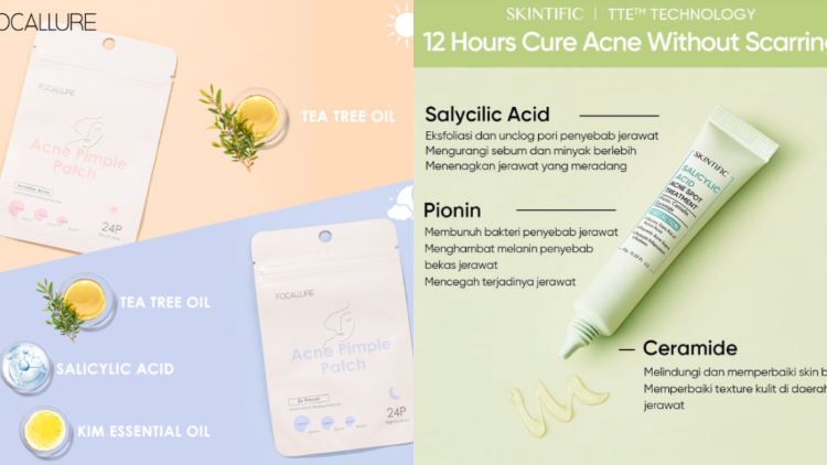 Perbandingan Acne Patch vs Acne Spot Gel. Menurut Hipwee, yang ini Paling Ampuh!