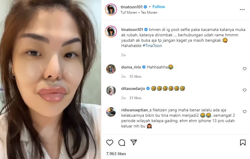 Tanggapan Tina Toon Terhadap Komentar Netizen Tentang Bentuk Wajahnya