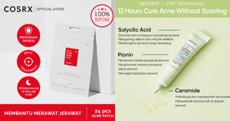 Perbandingan Acne Patch vs Acne Spot Gel. Menurut Hipwee, yang ini Paling Ampuh!