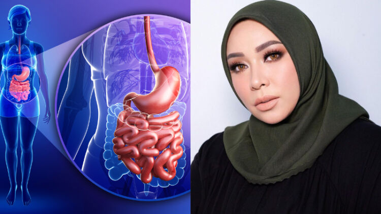 Bariatrik, Operasi Penurunan Berat Badan Seperti yang Dijalani Melly Goeslaw