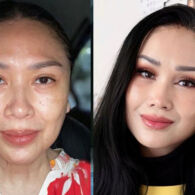 Titi DJ Blak-blakan Soal Operasi Anti Aging, Bikin Penampilanya Lebih Muda